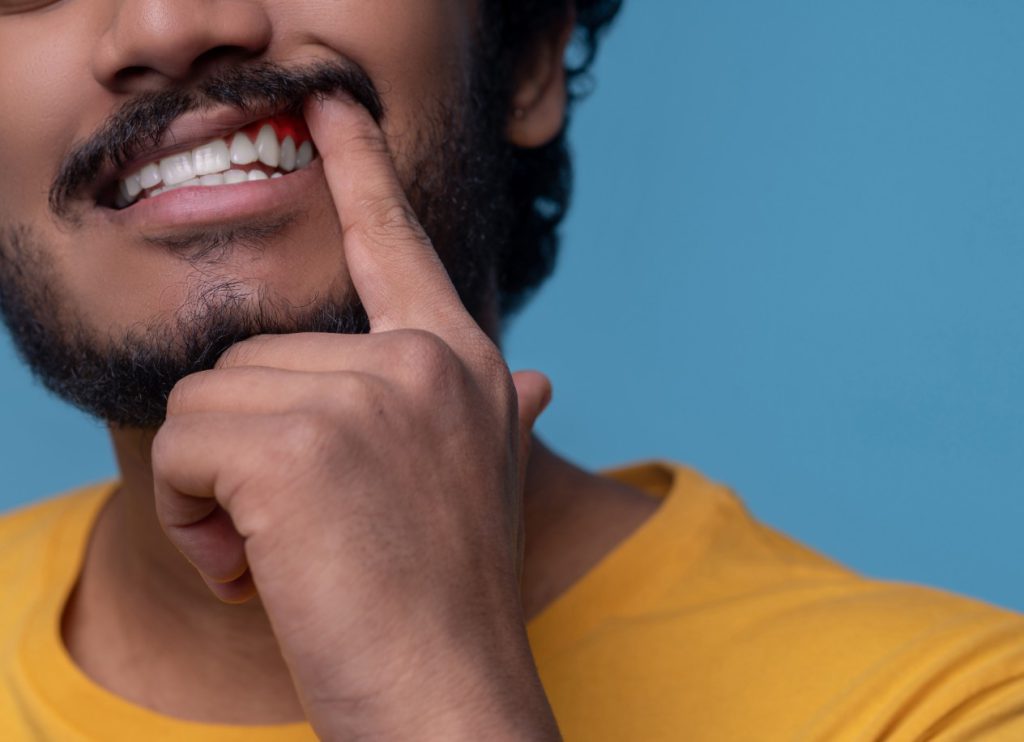Solutions for Receding Gums in Lakewood, CO