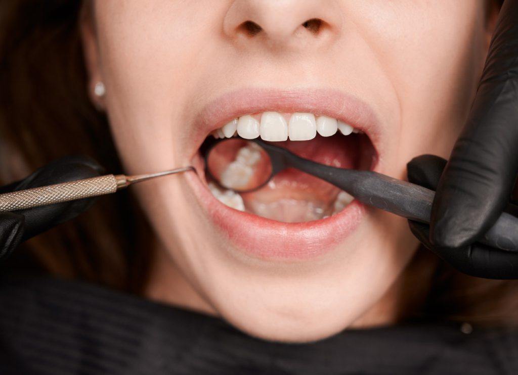 The Connection Between Gum Health and Overall Health