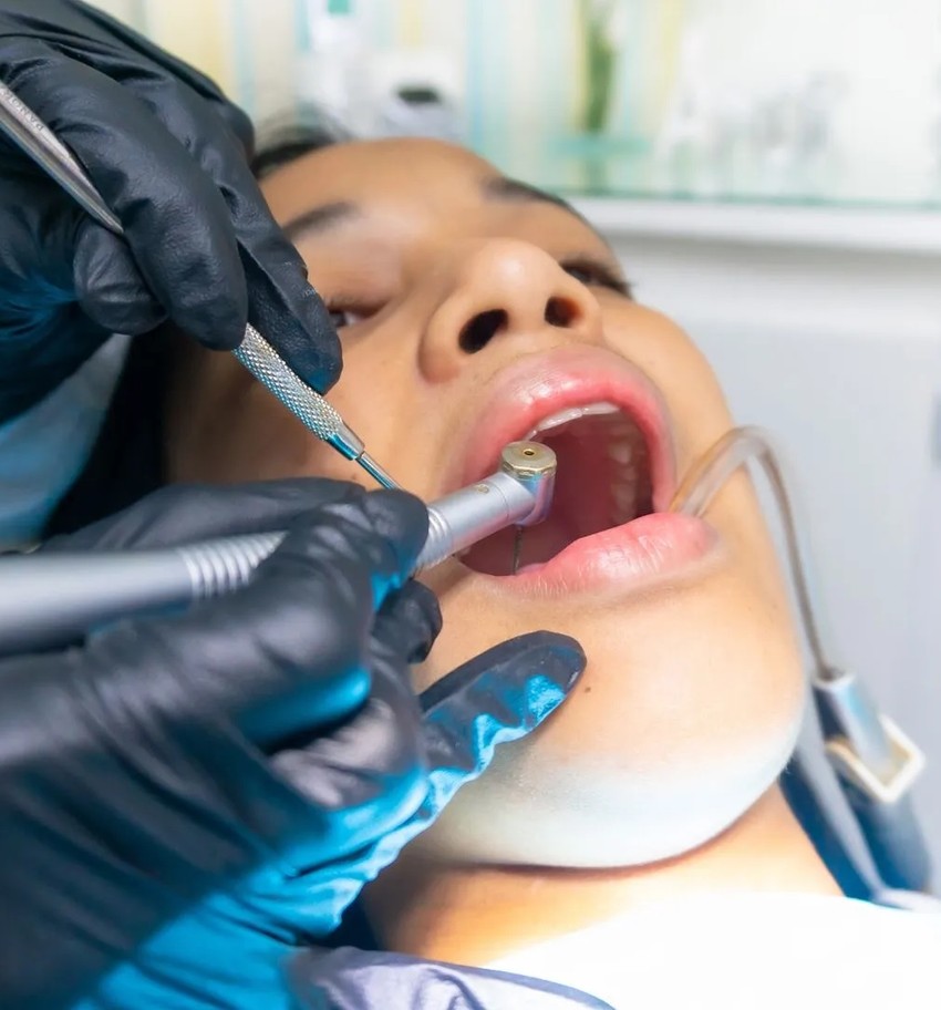 A Comprehensive Guide To Dental Fillings in Lakewood, CO