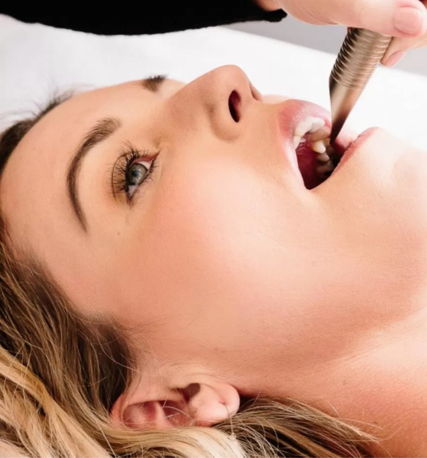 woman getting nightlase treatment