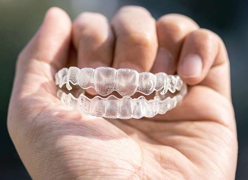 Improve Speech with Invisalign Aligners