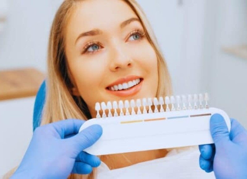 Life After Porcelain Veneers