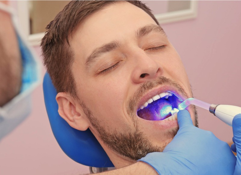 Understanding Dental Fillings in Lakewood