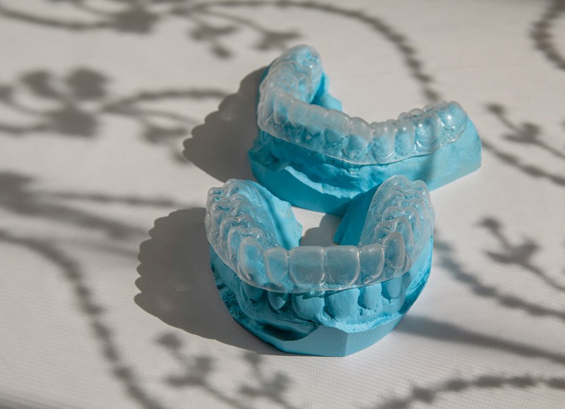 Can Invisalign Fix Gaps Between Teeth? All You Need to Know