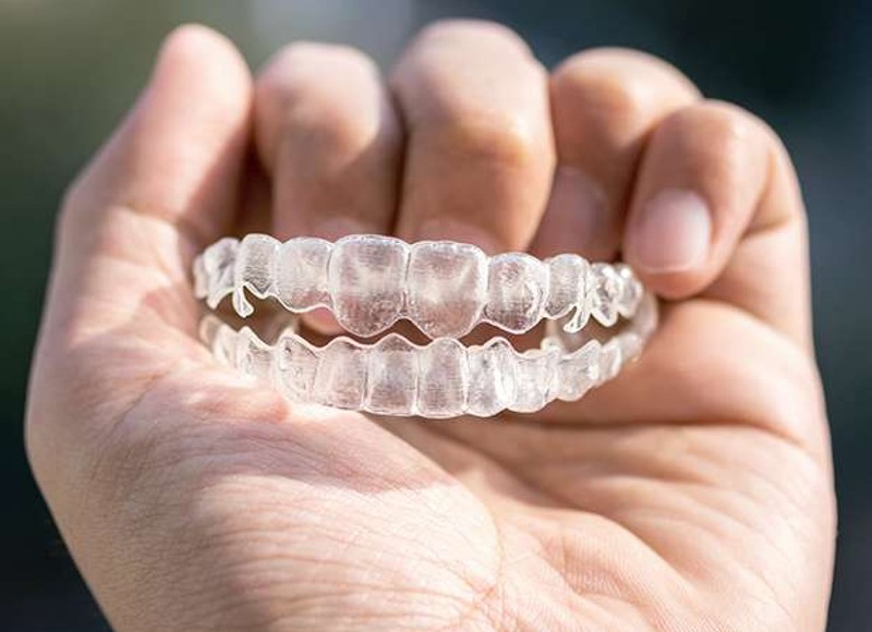 The Permanent Solution: A Comprehensive Guide to Dental Implants