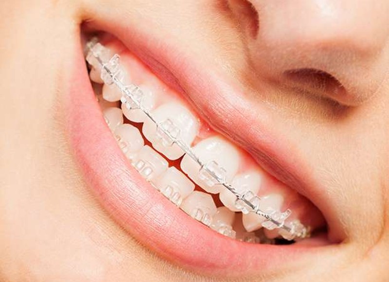Restoring the Whole Smile: Bridges, Dentures, and Emergency Care