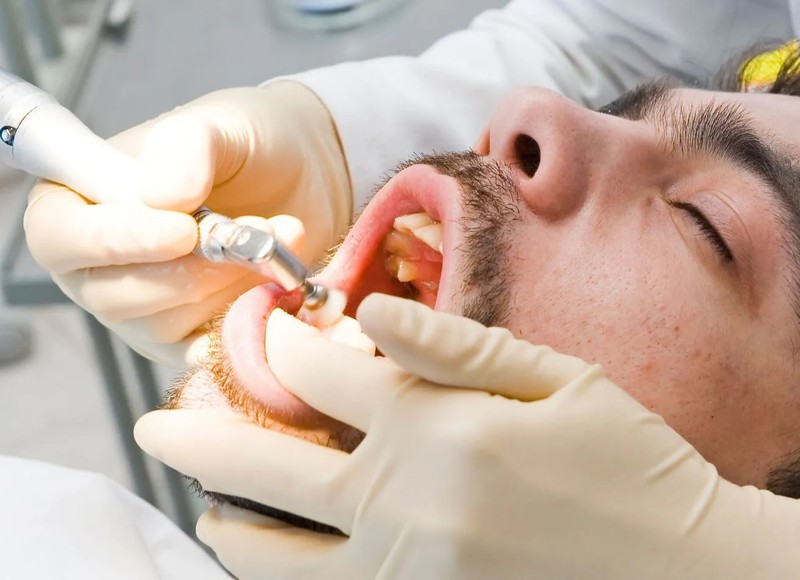 Adult Braces: Clear vs. Traditional Options