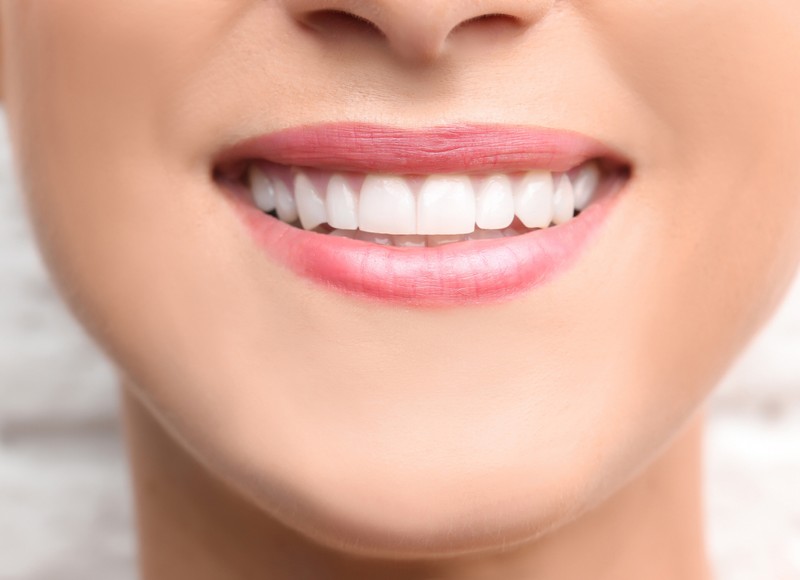 Cosmetic Bonding: A Simple Way to Improve Your Smile