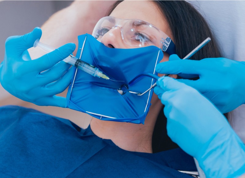 Managing Pain After Root Canal in Lakewood