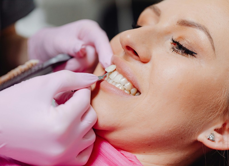 Discover the Benefits of Porcelain Veneers