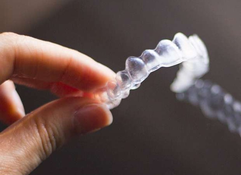 Invisalign Solutions for Common Orthodontic Issues