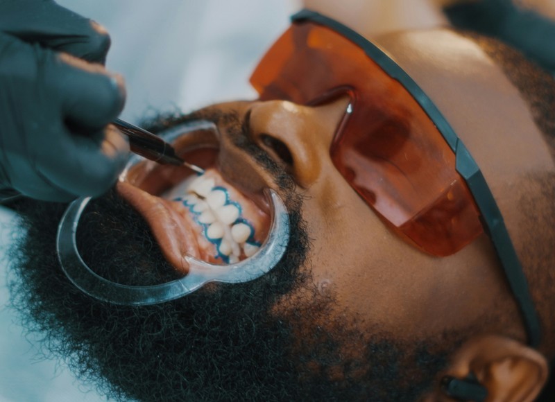 Brighten Your Smile with Lakewood Cosmetic Dentistry